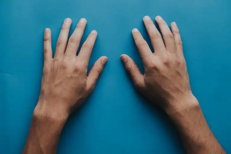 Cold Hands and Feet: What’s Actually Behind It
