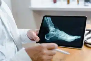 Gout Symptoms: The Pattern That Identifies a Flare