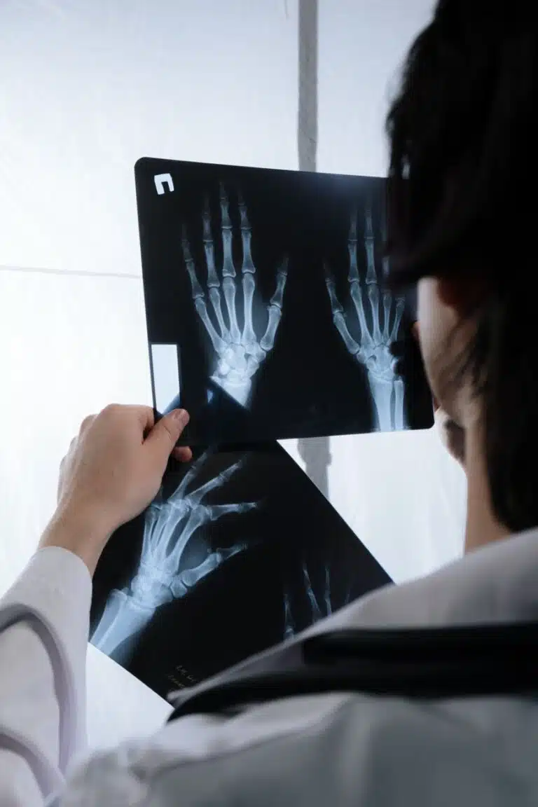 Rheumatoid Arthritis in Hands: Early Signs and Why Timing Matters